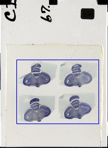 Media type: image; Special Collections 3298   shows specimen_part histological serial section;